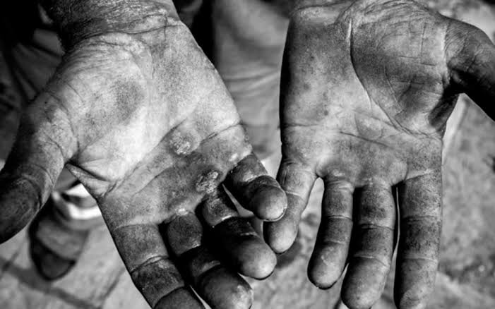 Trabalho escravo (reprise)