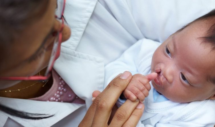 GettyImages Criança com labio leporino