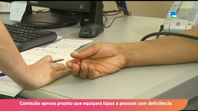 Comissão aprova projeto que equipara lúpus a pessoas com deficiência