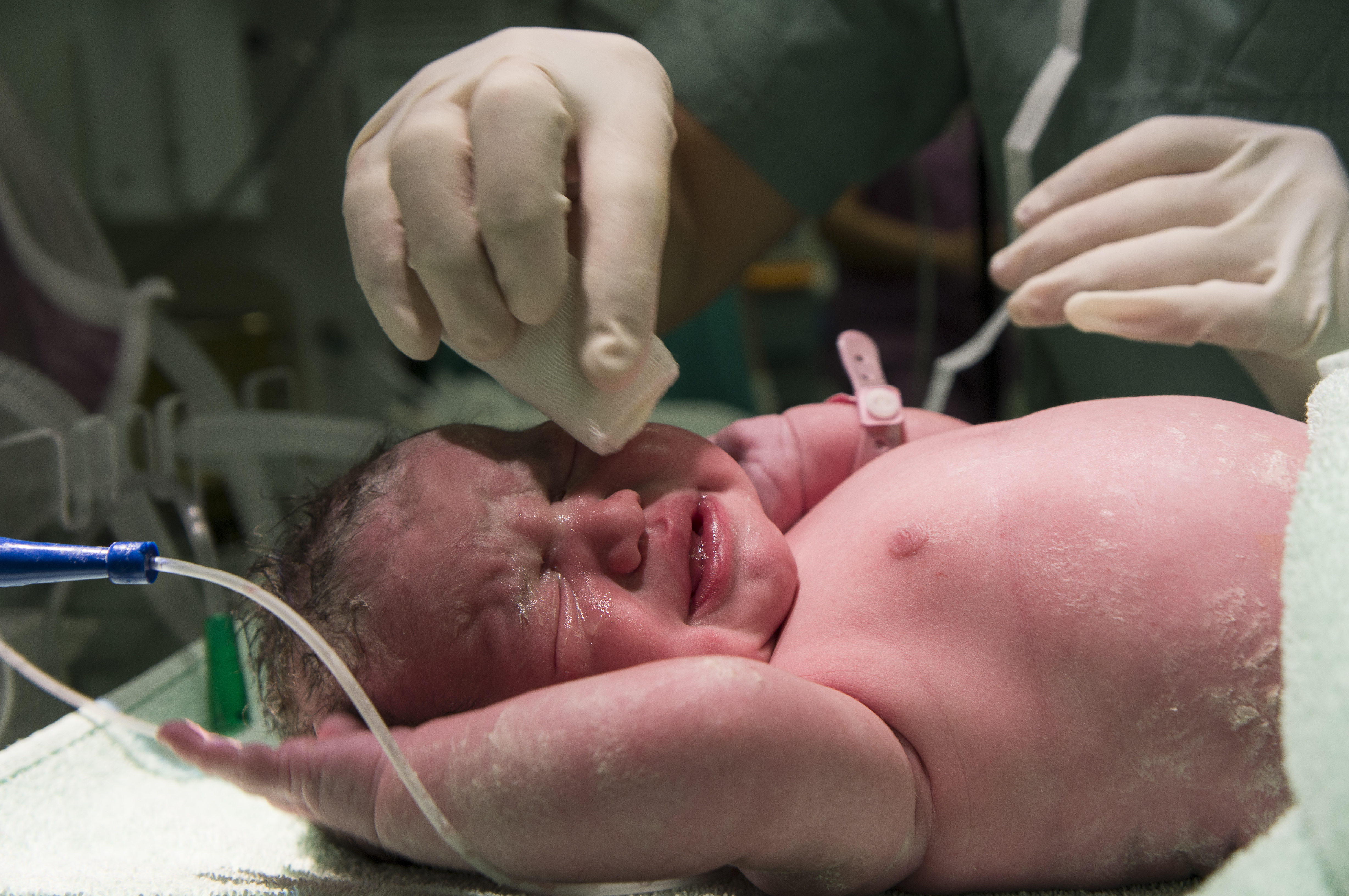 Testes Neonatais e Prematuridade