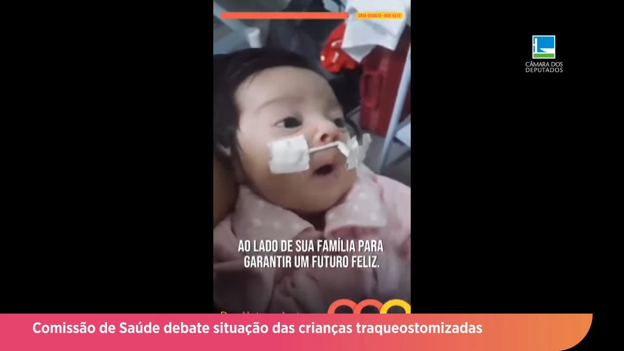 Situação das crianças traqueostomizadas é tema de audiência publica
