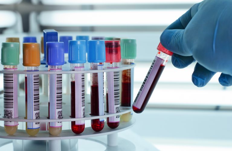 Lei determina que empresas divulguem campanhas de conscientização sobre vacinas, HPV e câncer – Notícias Lei determina que empresas divulguem campanhas de conscientização sobre vacinas, HPV e câncer – Notícias