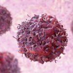 Nova lei inclui a imunoterapia em protocolos de tratamento do câncer